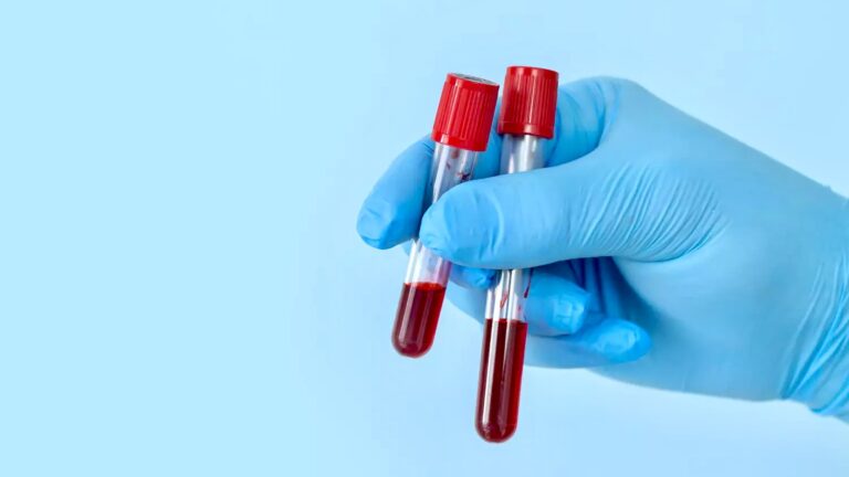 Gabon : l’électrophorèse de l’hémoglobine, un test clé pour prévenir la drépanocytose